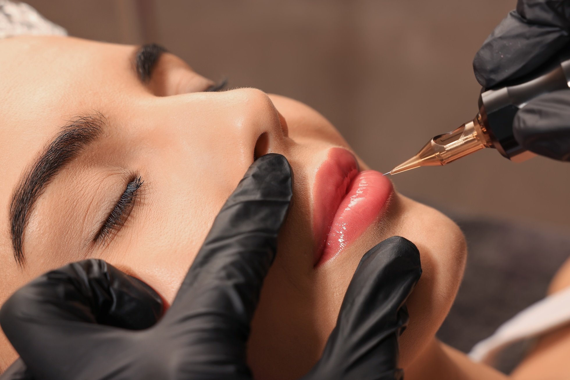 Patient receiving injection to the lip